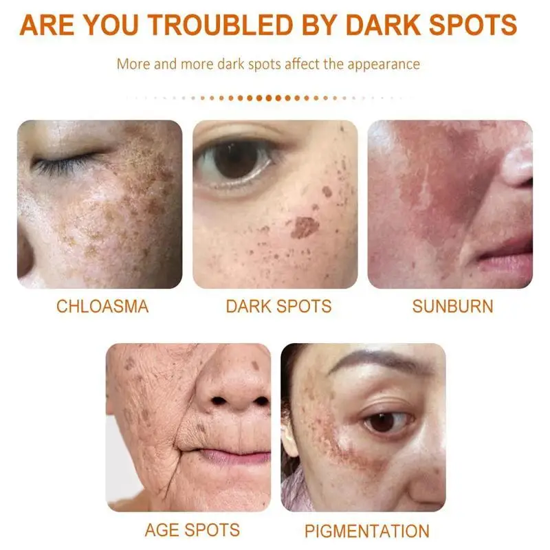 Face Brightening Cream Niacinamide Reduce Melasma Melanin Lighten Dark Skin Chloasma Serum Weaken Fine Lines Care niacinamide serum whitening body cream