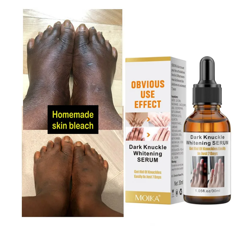 Remove Bleaching Product on Hands and Legs At Home Whitening Cream for Dark Skin Lightening Body Oil