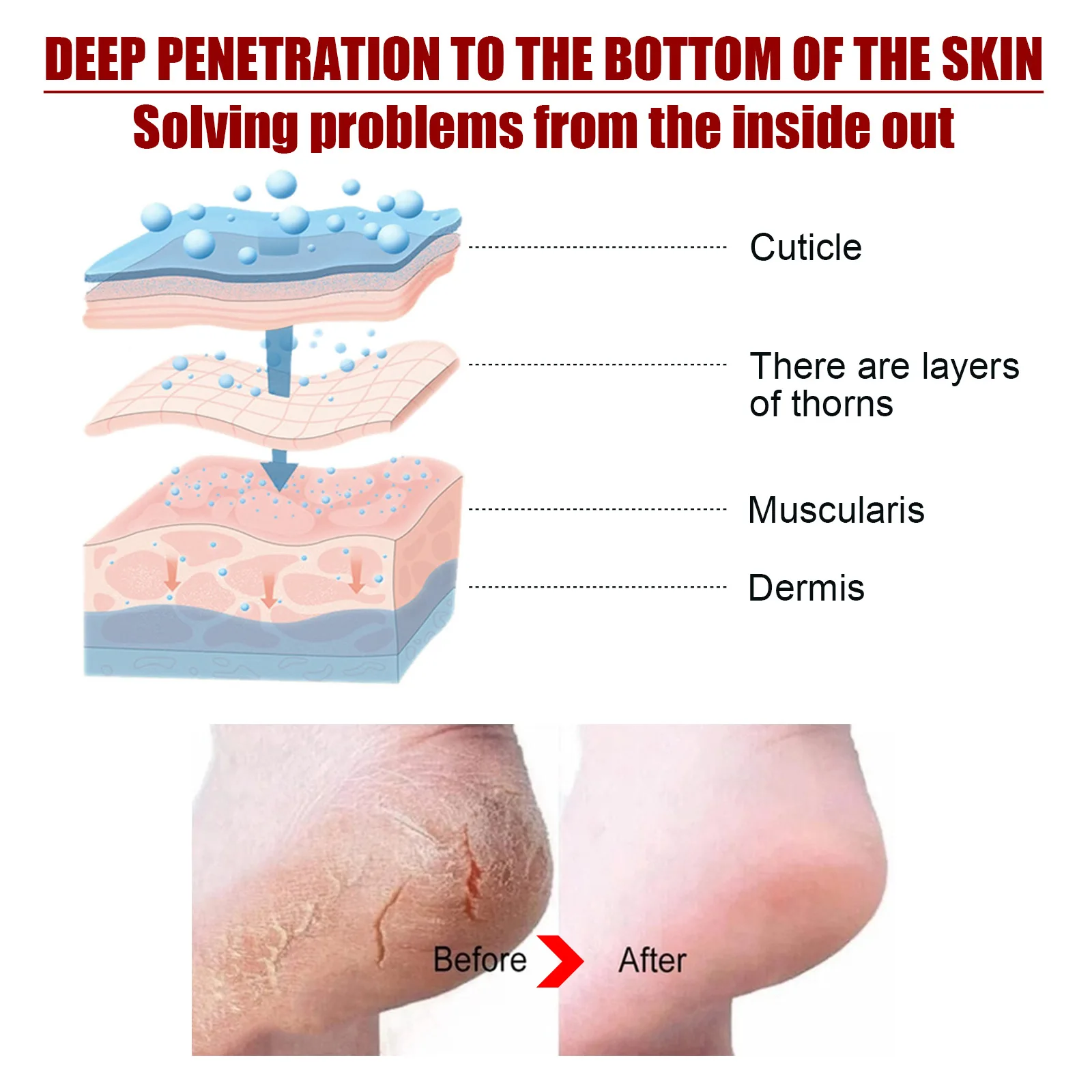Foot Peel Mask Skin Exfoliating Foot Mask for Dry Rough Cracked Feet Heels Callus Dead Skin Remover Waterproof Feet Peeling Mask