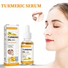 Turmeric Remove Dark Spots Essential Oil Anti wrinkle Serum 100% Pure Therapeutic Grade Face Whitening Moisturizing Skin Care 3
