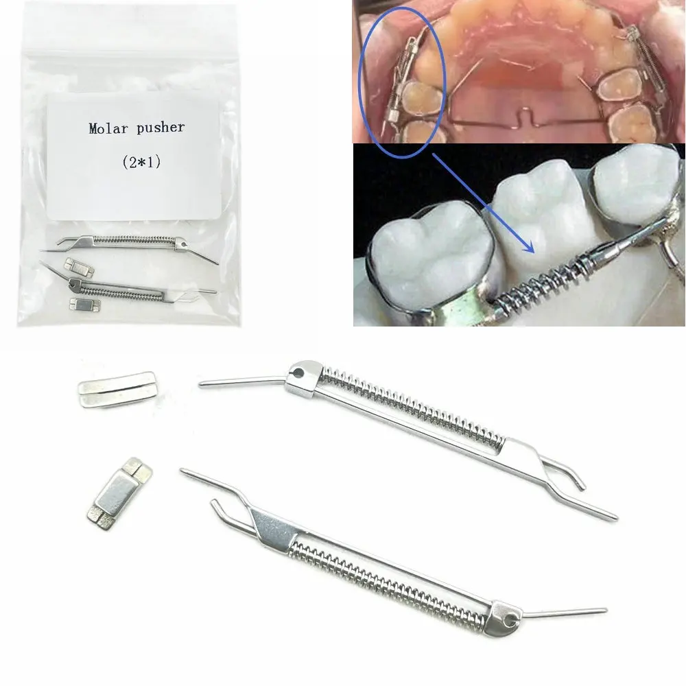 2pcs/pack Dental Orthodontics Molar Pusher Orthodontic Arch Expander