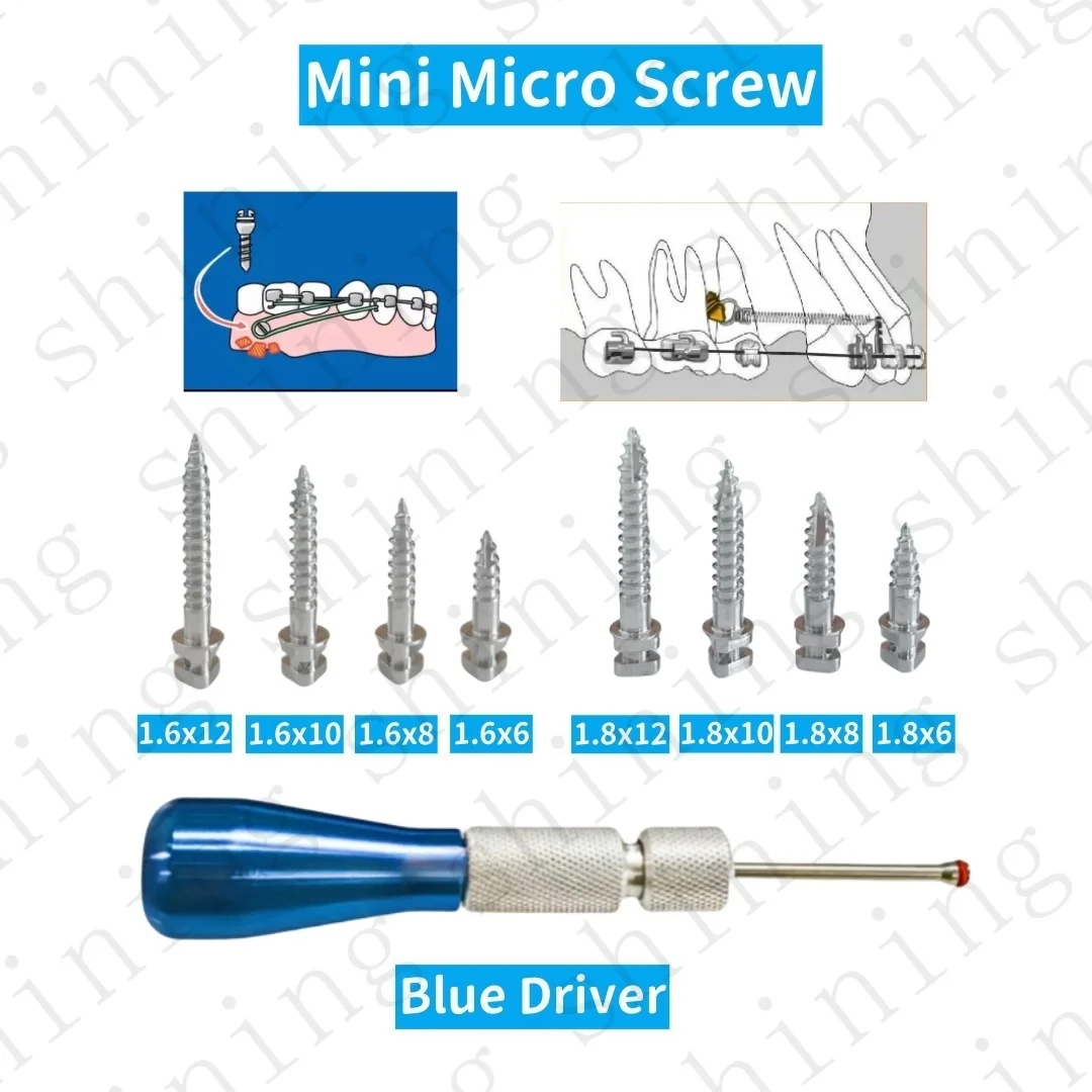 치과용 미니 나사 Ortho Achor 316LVM 마이크로 나사 드라이버 세트 삼각형 앵커리지 TAS 스타일