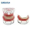 Dental Teeth Model with Implant Overdenture Inferior Demo Mandibular Model Dentist Student Learning Model 6