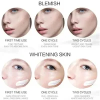 1/3/5 pièces crème blanchissante pour les taches de rousseur Niacinamide élimine les taches foncées crème Anti-taches de rousseur et vieillissement estompe Pigmentation Melasma peau 6