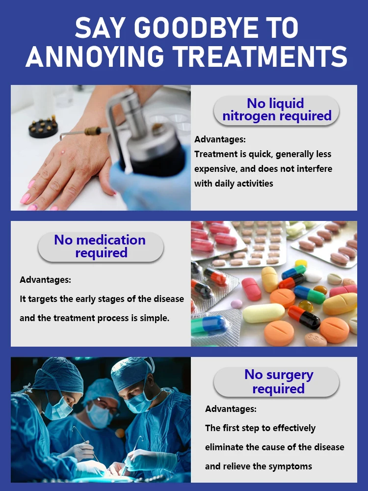 Acne Laser Therapy Pen 2