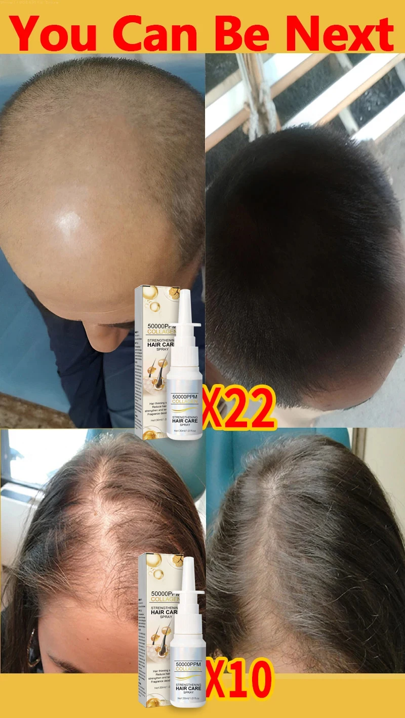 Description Picture 4 of itemHair Growth Spray Anti Hair Loss Essence Hair Regrowth Serum Treatment Alopecia Prevent Baldness Nourish Scalp 30ml