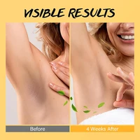 Underarm Detox Scrub Turmeric Vitamin C Dark Spot Armpit Remover - Image 5