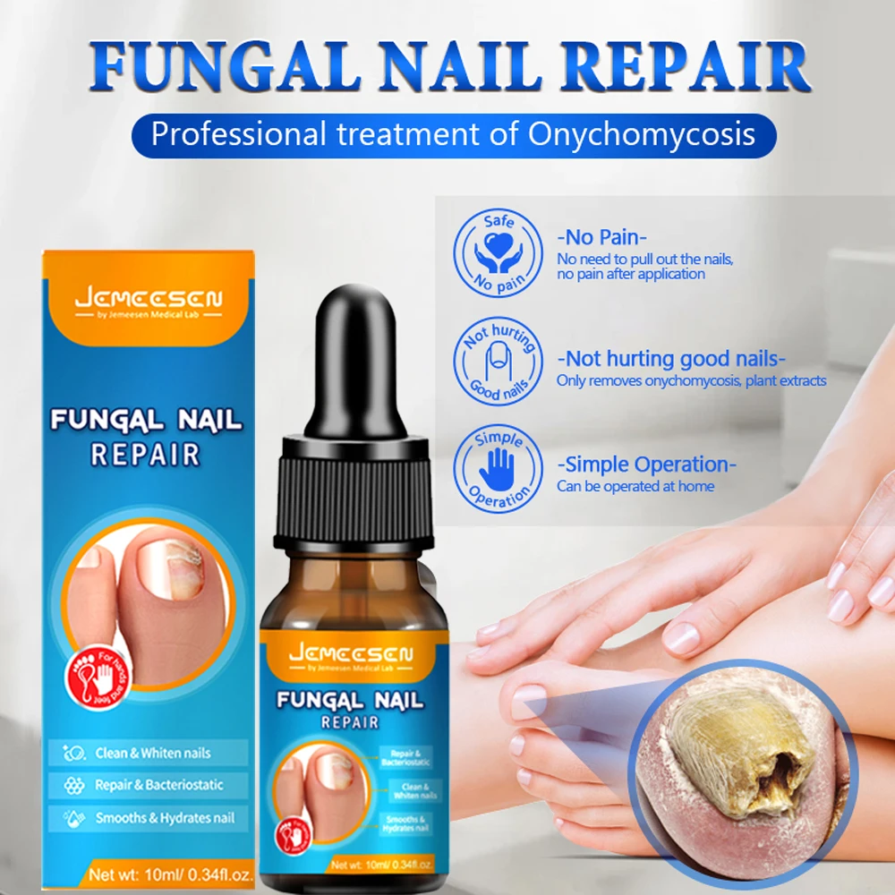 Jemeesen Fungus Removal Serum Gel Anti Infection Paronychia Onychomycos Nail Fungal Treatment Feet Care Essence Repair Nail Oil For Nail Fungus Remover