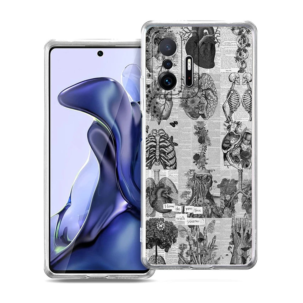 Transparent Soft TPU Shell with Anatomy Skeleton Chalkboard Heart Design