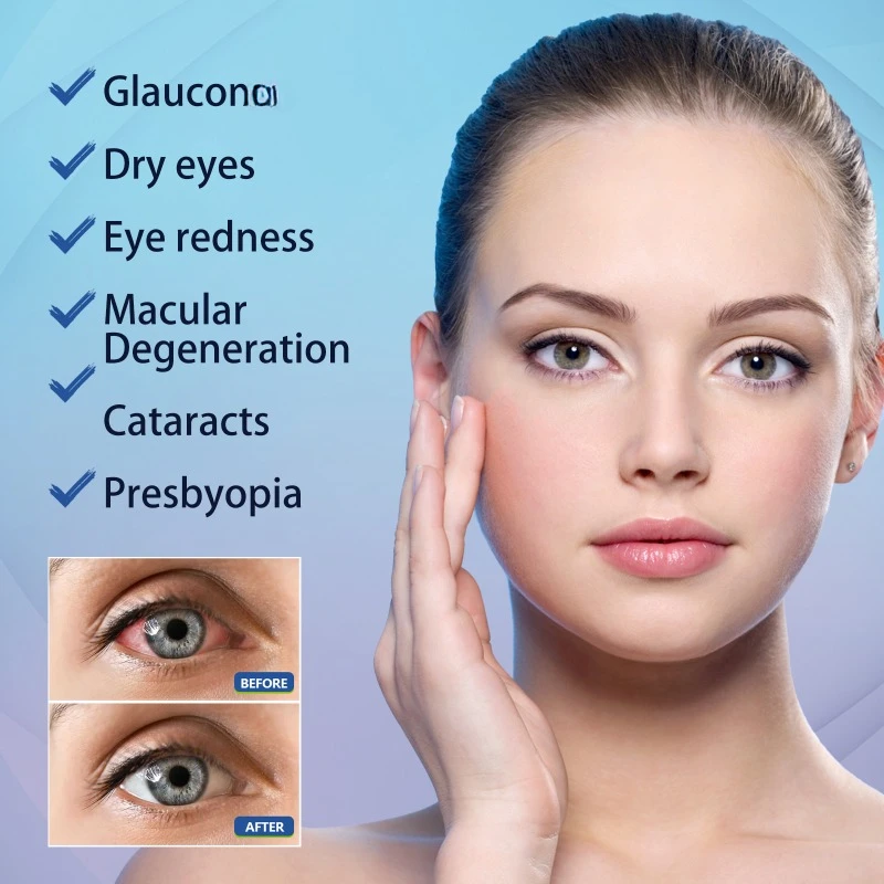 Eye Care Drops Eye Care Drops Treatment redness Blurred Vision Improve Enhance Eyesight Relief Eye Fatigue Dry itch Sooth Eyesight