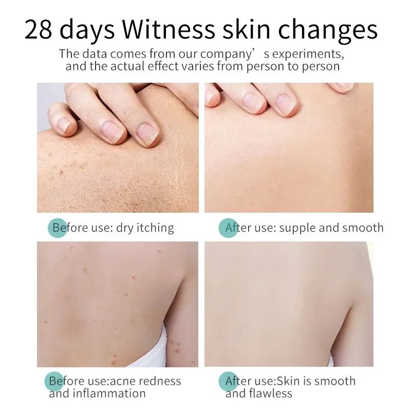 330ml Tea Tree Essential Oil Acne Body Wash Cleansing Moisturizing Leaving Fragrance Shower Oil Bath Body Wash Shower