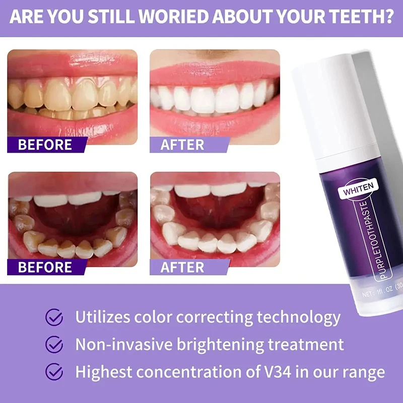 V34 Teeth Whitening Toothpaste 5d Tooth Brightening Oral Hygiene Cleaning Dental Bleaching Tools Fresh Breath Dentistry Care teeth whitening product,teeth whitening essence,teeth health product