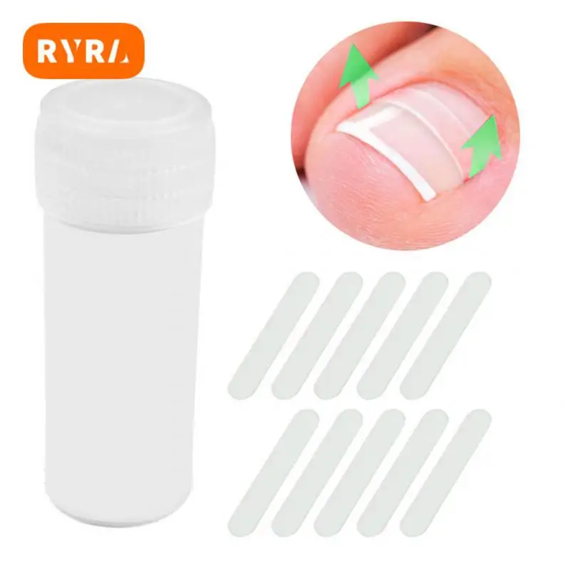 

Ingrown Toe Nail Easy To Use Advanced Elastic How To Treat Ingrown Nails Self-care Toe Care Effective Solution Revolutionary