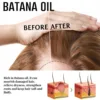 Anti Hair Loss Shampoo Repair Baldness Reduce Dandruff Itching Scalp Treatment Strengthen Thicken Nourishing Hair Growth Shampoo 4