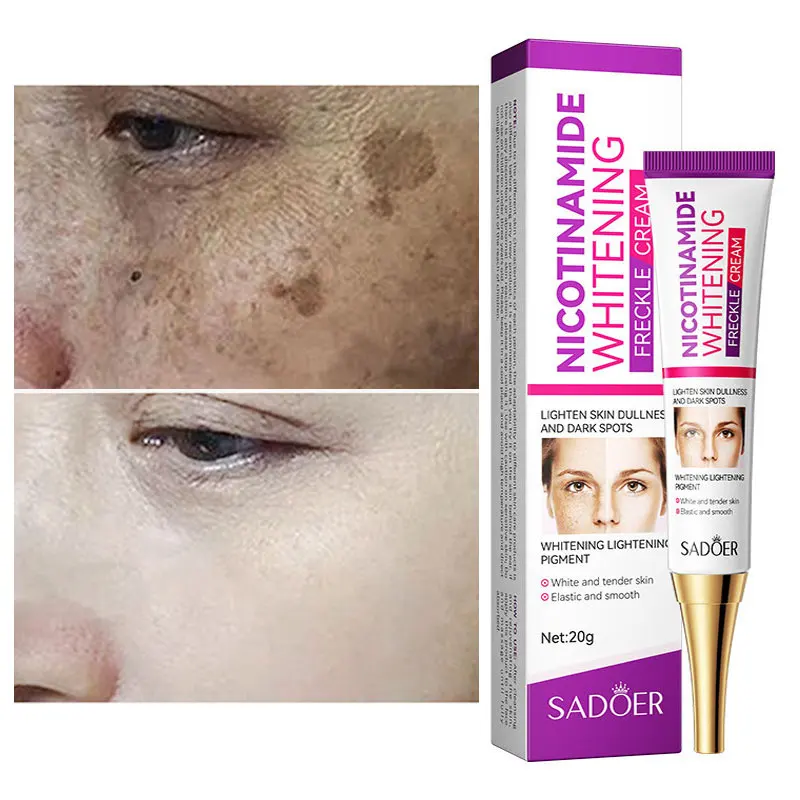 

Nicotinamide Whitening Freckles Cream Brightens Skin Tone Face Remove Melasma Dark Spot Acne Marks Lightening Melanin