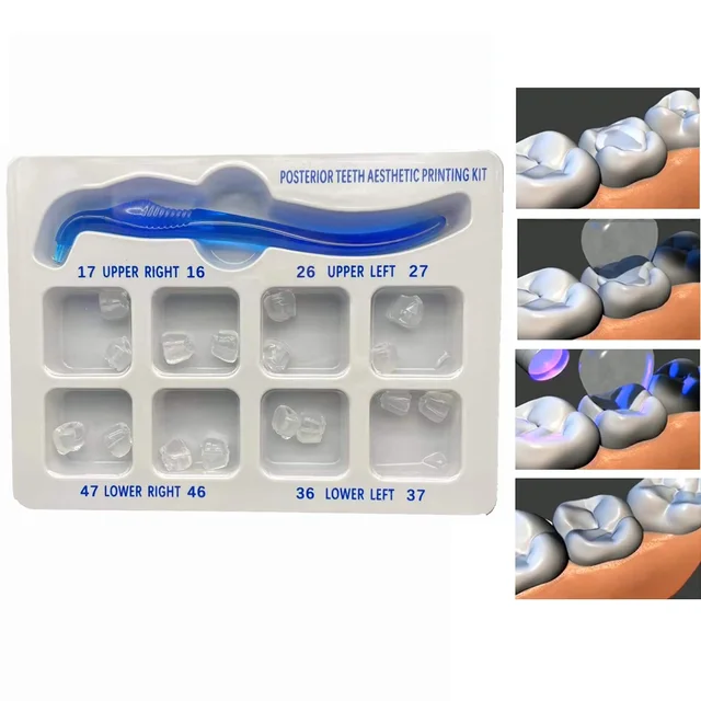 Dental Posterior Teeth Aesthetic Printing Mould Kit For Light Cure Composite Restoration Filling Tools