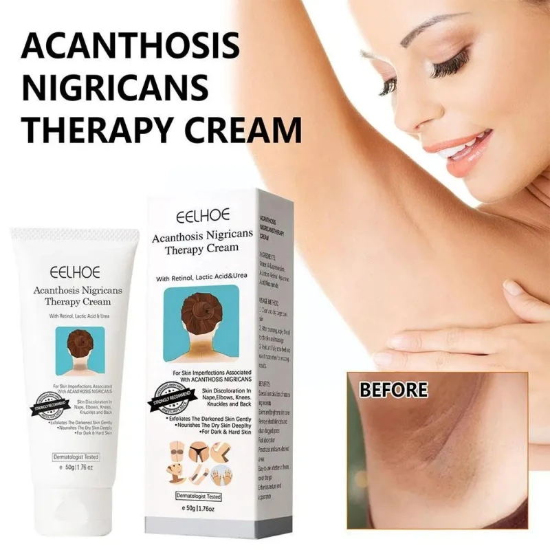 

Black Acanthoderma Repair Cream Suitable for Dark Skin Crotch Armpit Remove Armpits Knees Joints Black Moisturizing Body Cream