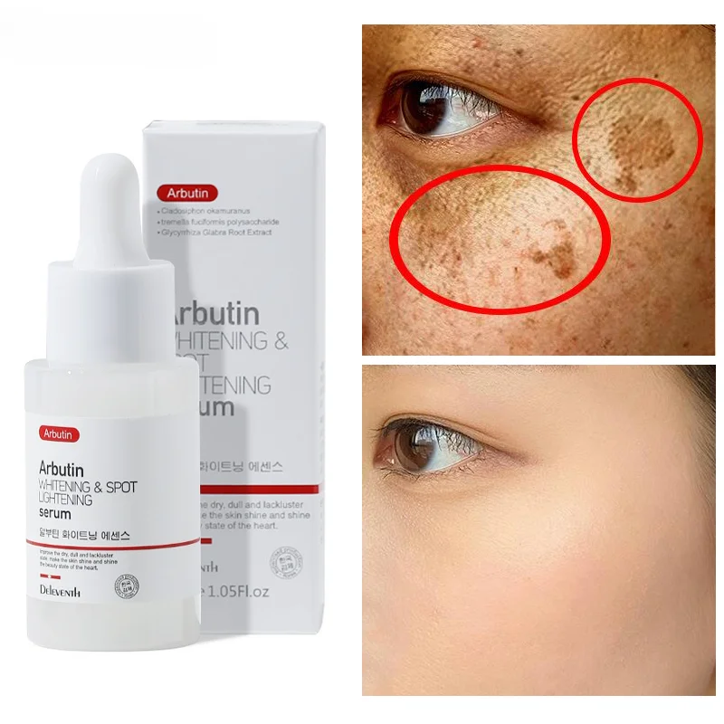 

Arbutin Whitening Freckle Face Serum Remove Melasma Essence Fade Dark Spots Melanin Brighten Skin Pigment Correction Products