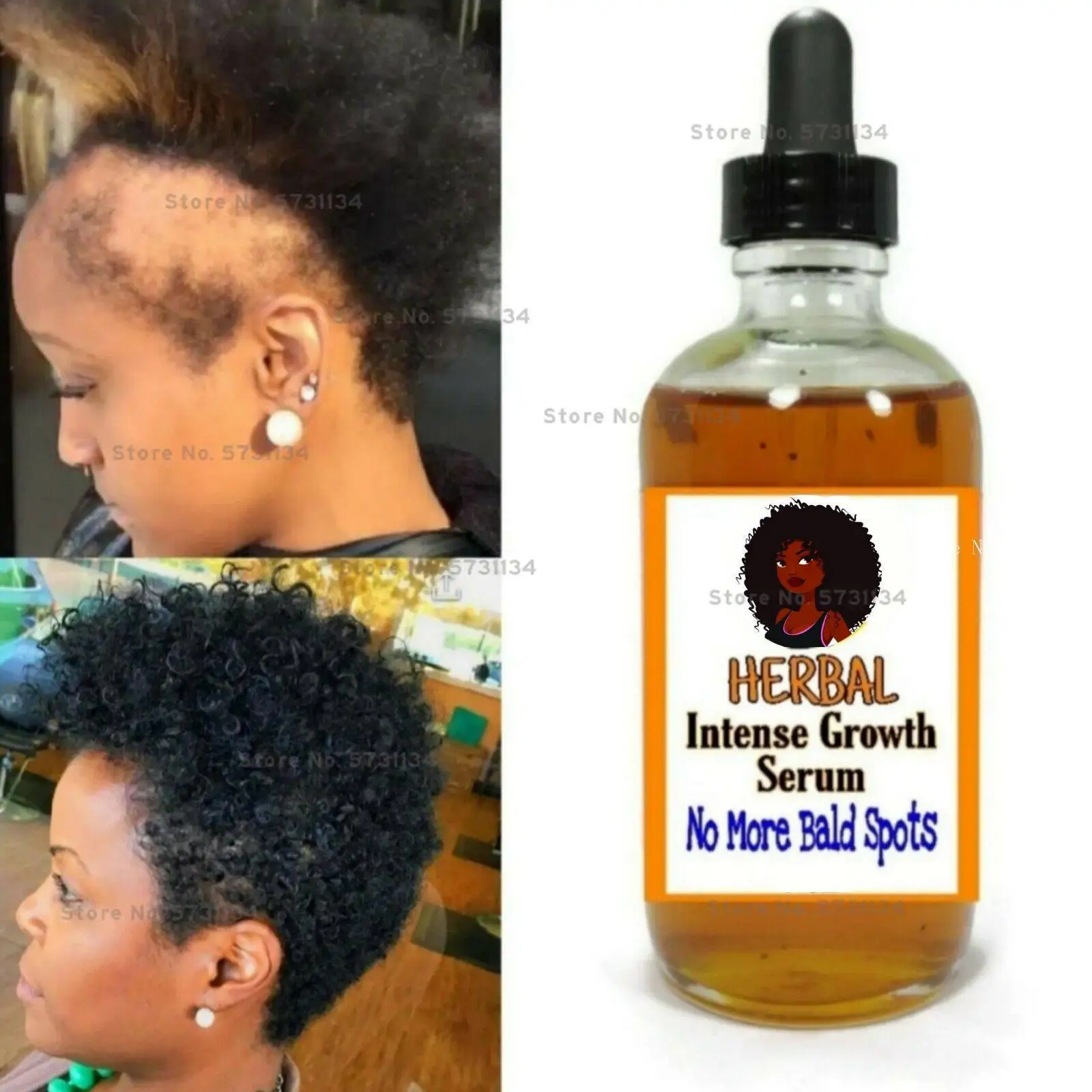 Black Seed Castor Oil Hair Growth Serum, Thick Hair, Fast Growth 20ml Free  Shipping - Hair Growth Essential Oils - AliExpress