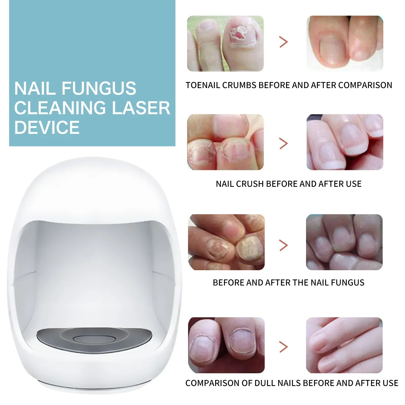 Nail Fungus Remover Nail Fungus Laser Treatment Device Repair Toenail Fingernail Treat Toenail Nail Fungal Treatment