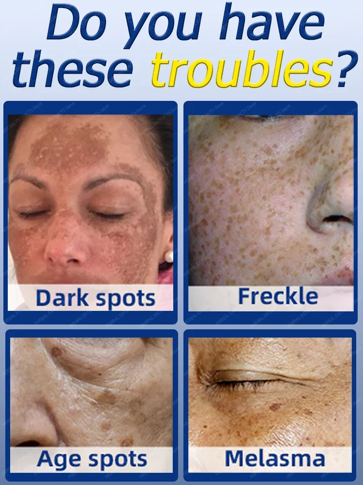 Dark Spot Remover For Face Cream Black Age 2