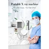 High-definition imaging design mini portable x ray machine for clinic hospital orthopedics 3