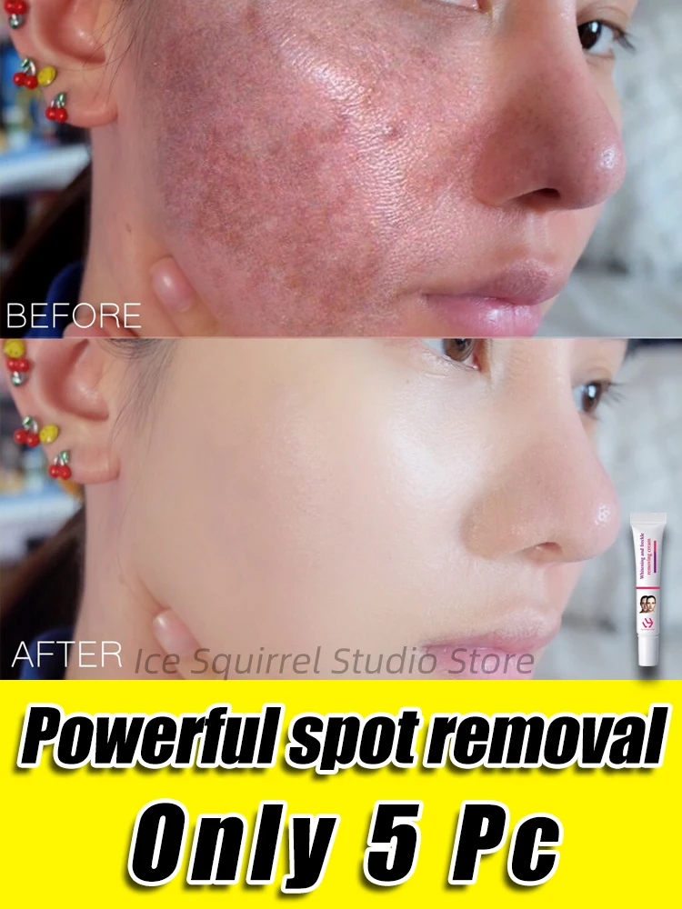 

Spot Removal Essence Remove Dark Spots Freckles Melasma Lighten Melanin Shrink Pores Anti Aging Blemish Removal