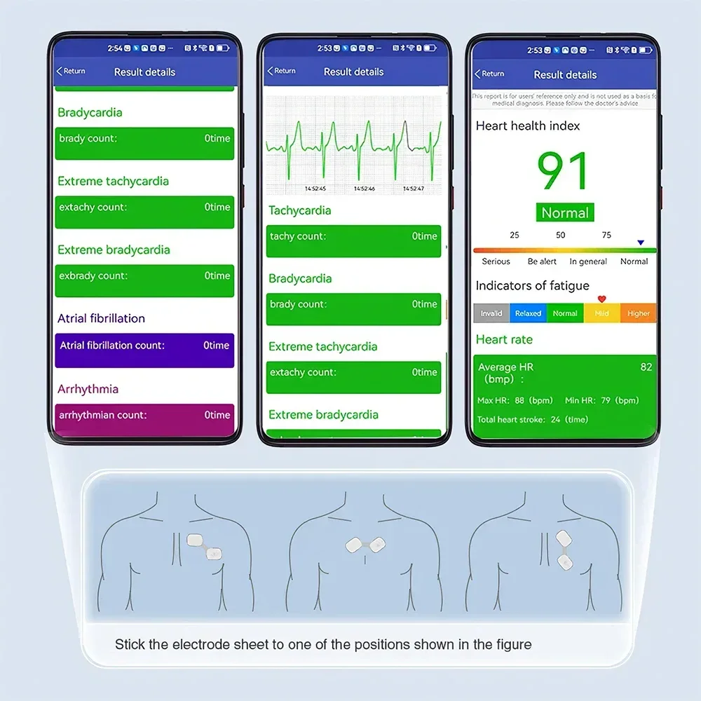 Bluetooth EKG Holter ECG Monitor 24 Hour Real-time Ultra-thin ECG Patch Wearable Wireless Recorder