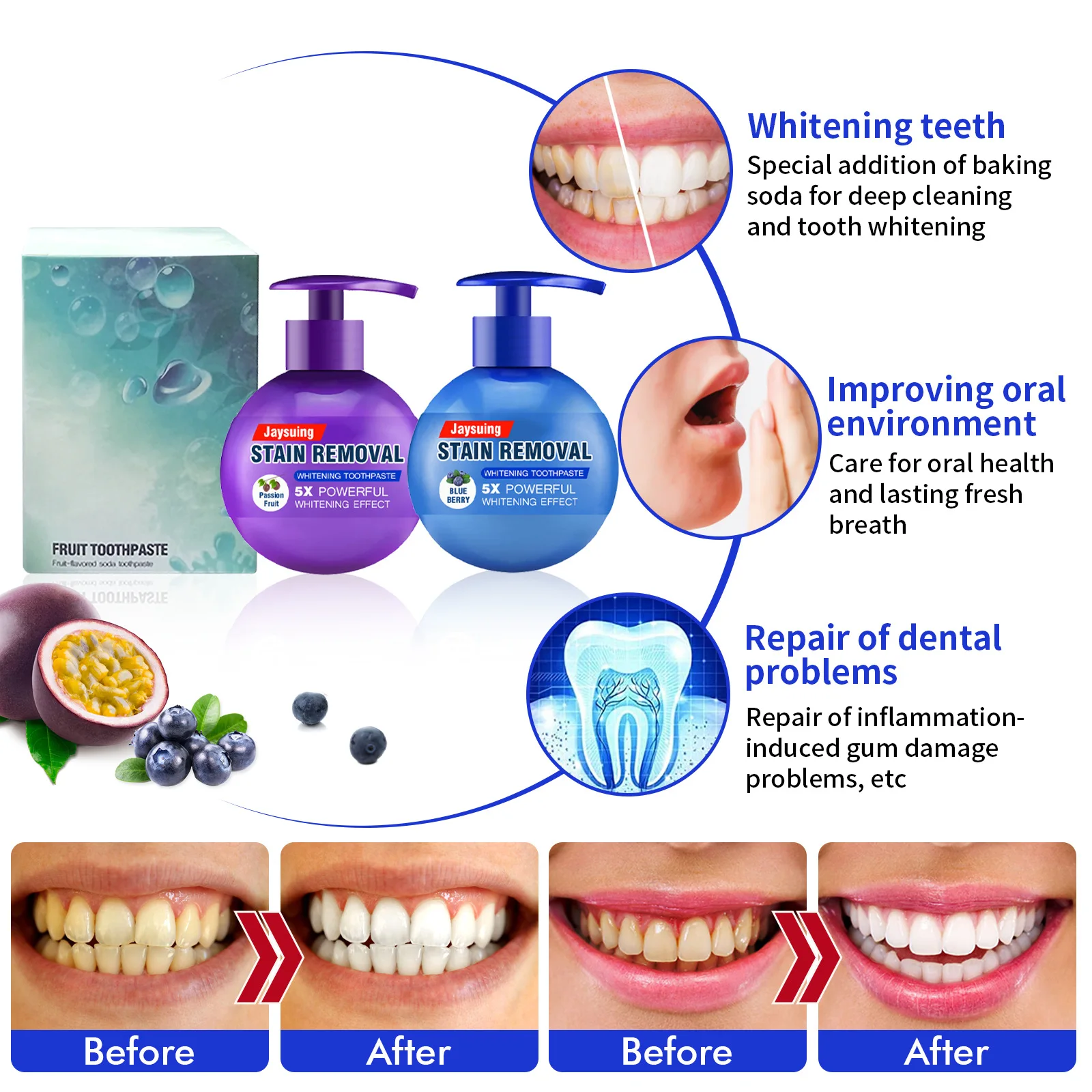 Baking Soda Teeth Damage