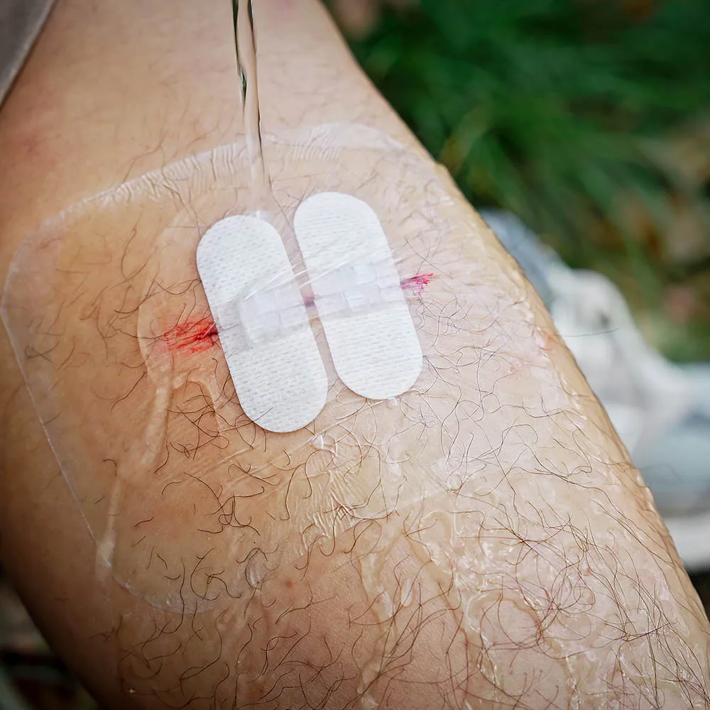 RHINO RESCUE Cut Care Kit-Zip Stitch Wound Closure Strips for Cut Care Device Home Camping