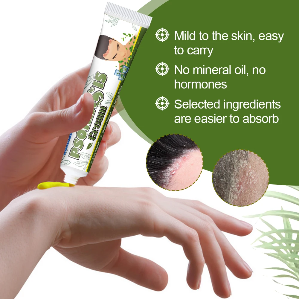 Sumifun Seborrheic Dermatitis Ointment Treatment Dermatitis Eczema Head Acne Pruritus Repair Scalp Hair Care Cream 20g skin care ointment