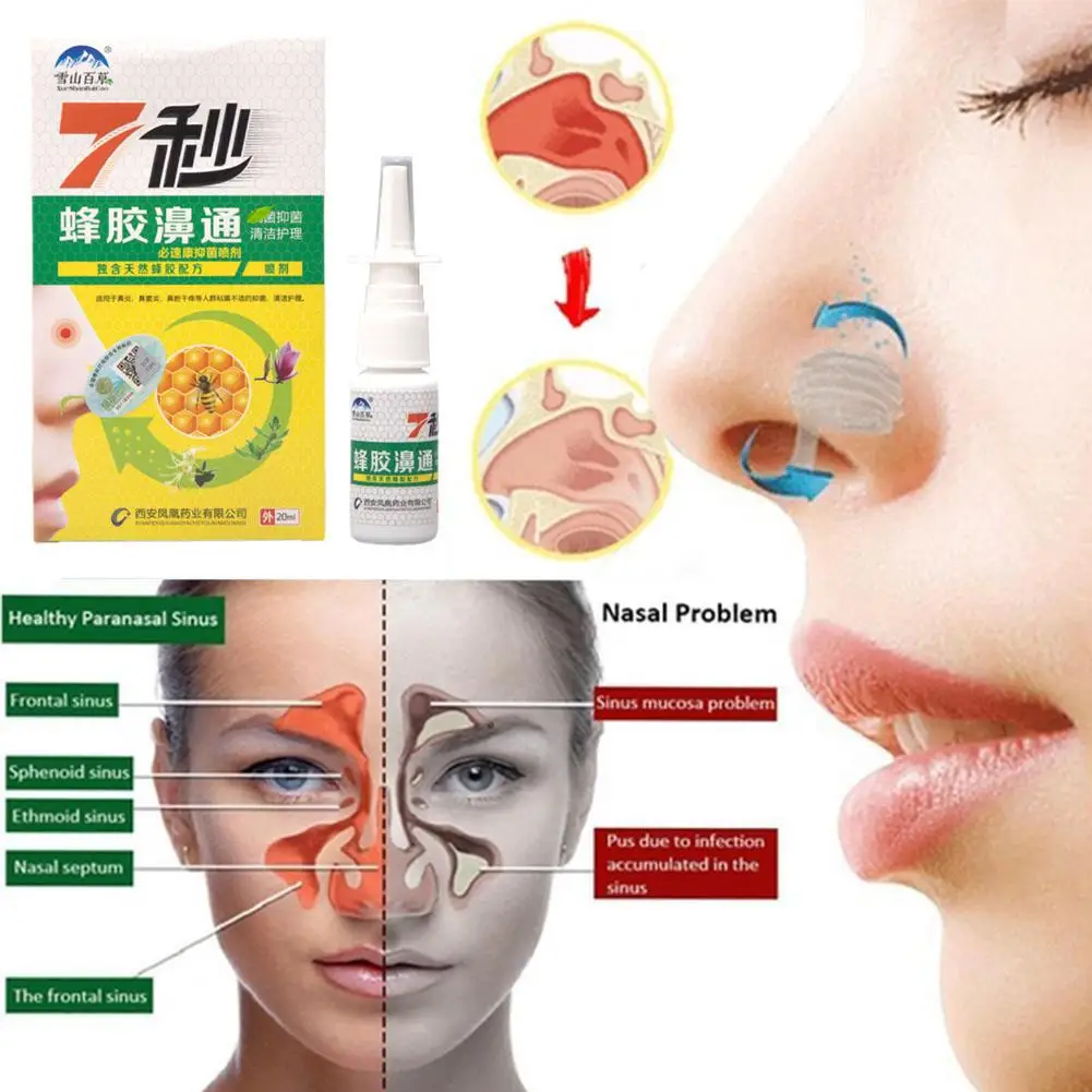Propolis Extract Nose Spray To Relieve Nasal Discomfort Drops Runny Itching Allergic Rhinitis Nose Health