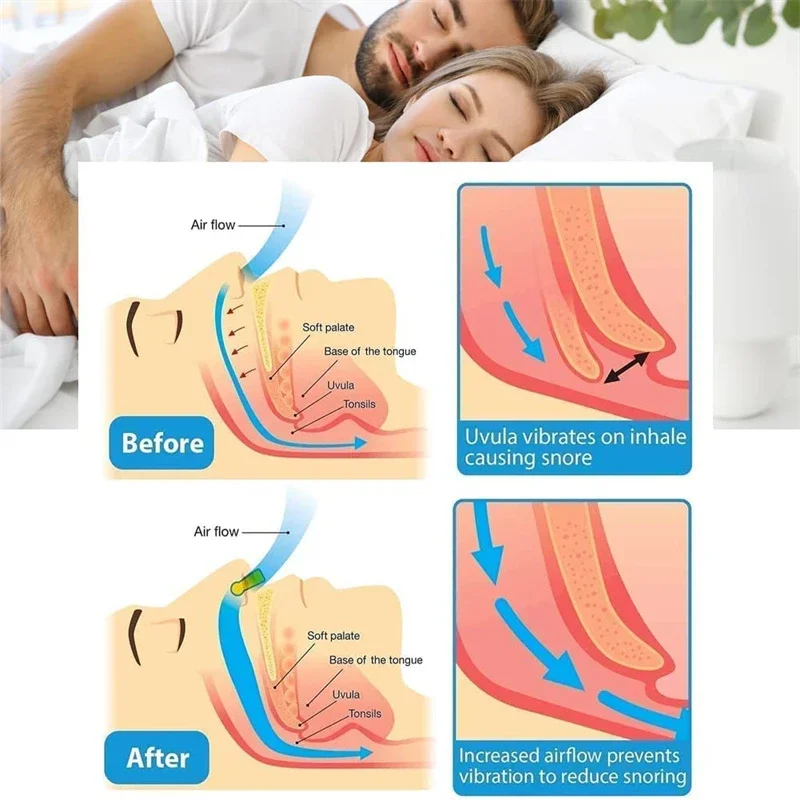 Anti Snoring Corrector Nose Clip Sleep Aid Device With Case