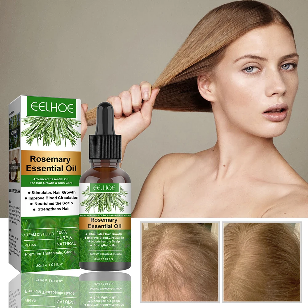 30ml Fast Hair Growth Essence Oil Nutrition Serum Hair Loss Treatment  Hairdressing Essential Oil Dry Damaged Hairs Serum Care - Hair Loss Product  Series - AliExpress
