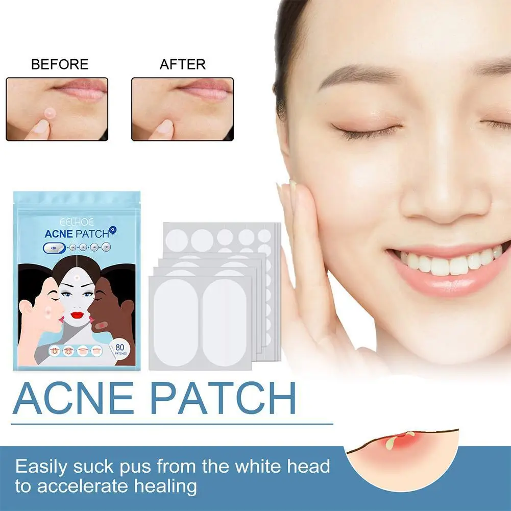 

80pcs/Set Acne Acne Patch Large Size Acne Patch Hydrocolloid Bandage For Acne Skin Blemish Remover Skin Care B4N0