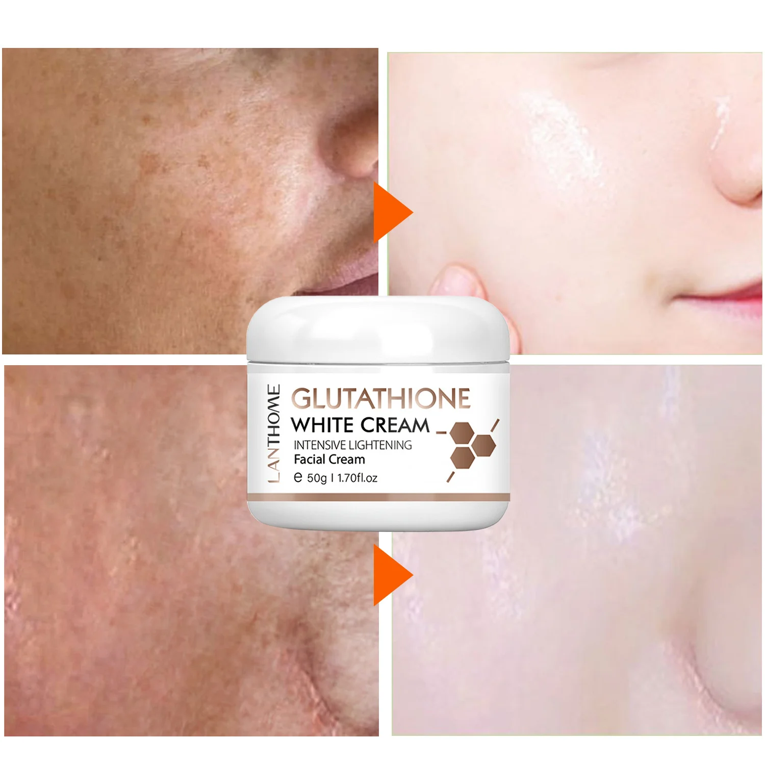 Glutathione Whitening Freckle Face Cream Remove Dark Spots Lighten Melasma Melanin Fade Acne Scars Anti-Aging_voghion.com