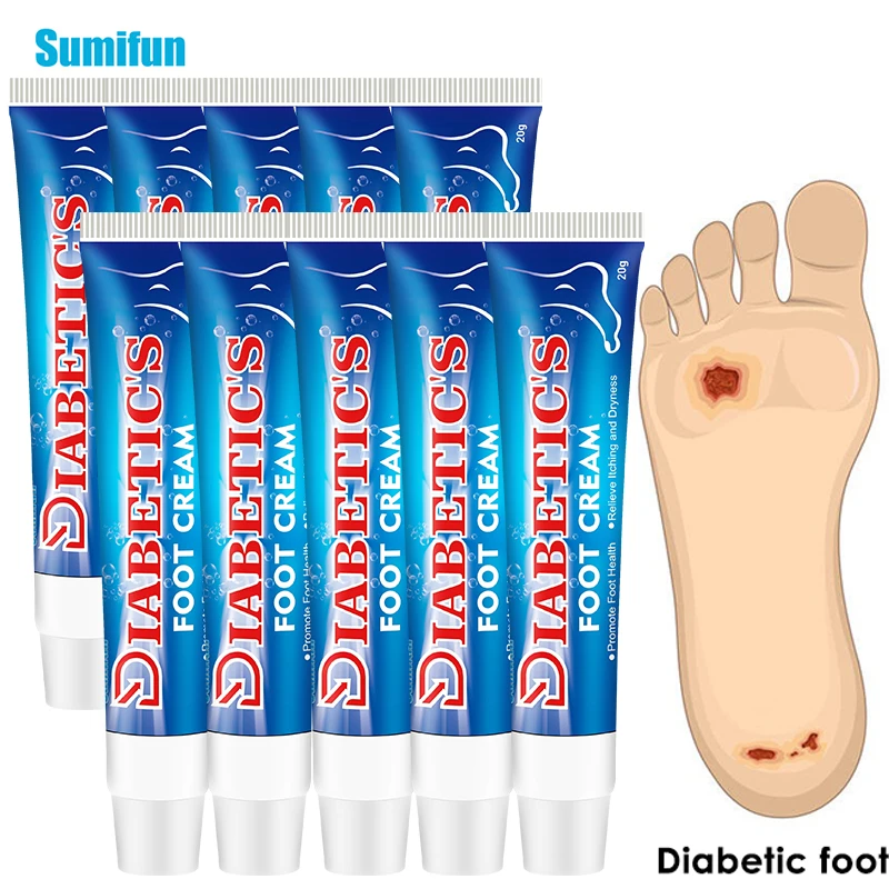 5/10pcs Sumifun Treat Diabetes Diabetic Foot Cream Anti Inflammation Foot Ulceration Cream Itch