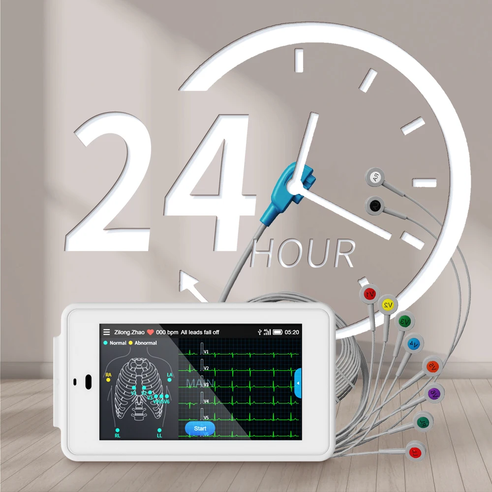 Wellue PC-ECG500 Pocket Ecg Monitor With Glasgow Analysis 6/12-lead Synchronous Acquisition Electrocardiography Ecg