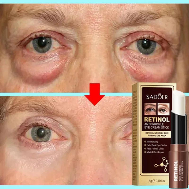 

Retinol Stick Anti-Wrinkle Eye Cream Get Rid Puffy Dark Circles Moisturizing Lift Fine Lines Whitening Health Repair Eye Care