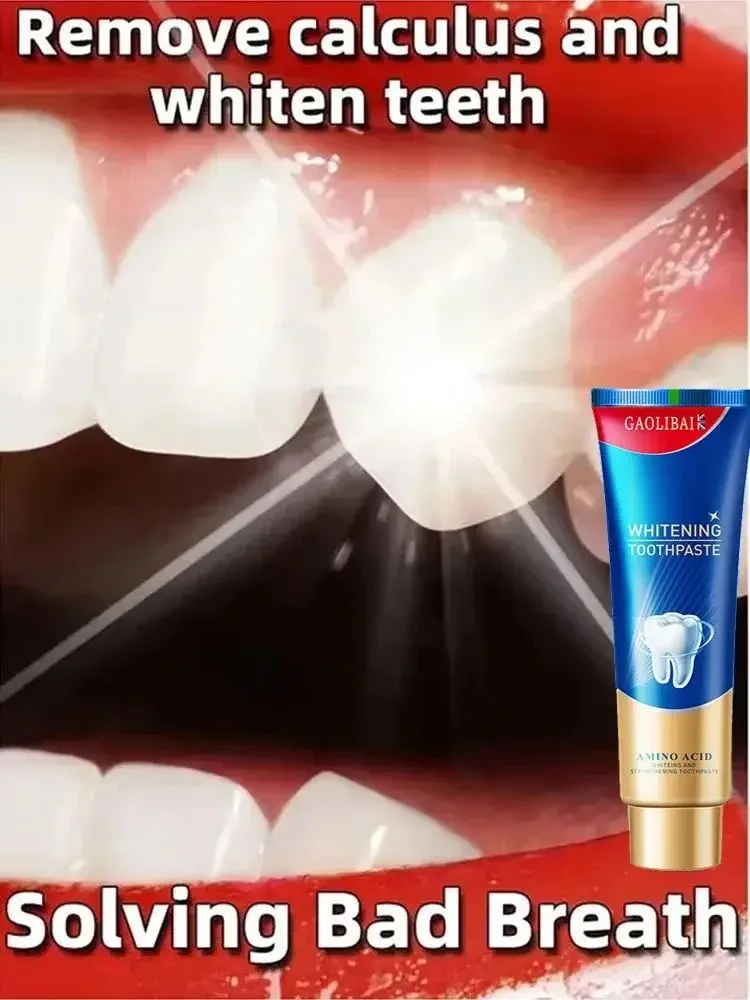 Dental Calculus Remover Whitening Bad Breath Teeth Toothpaste Brightening Preventing Periodontitis