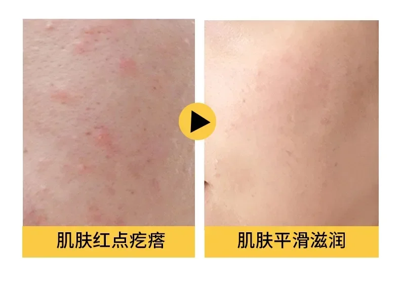 Рисунок 5 - Гель для душа для удаления клещей глубоко чистый