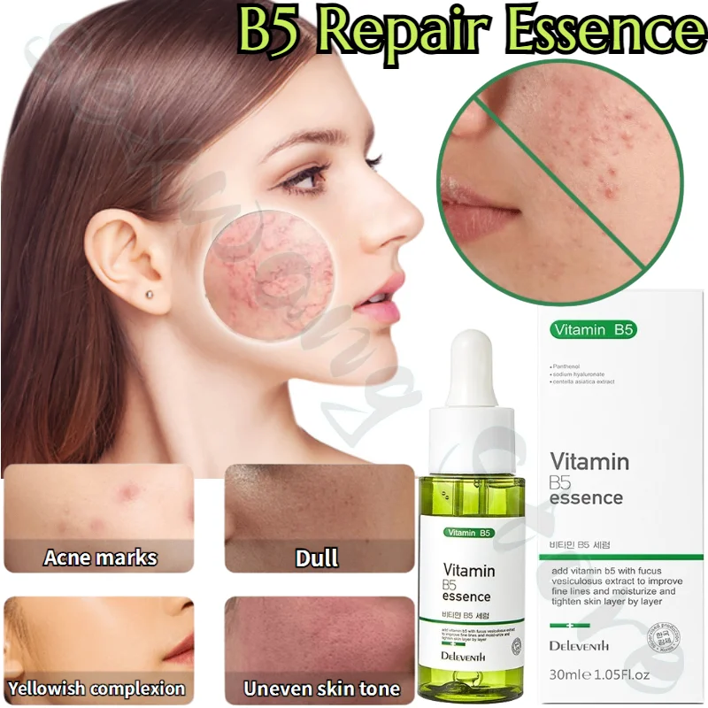 B5 Essence Repairs, Hydrates and Moisturizes After Sun Exposure, Dilutes Redness and Improves Acne-prone Skin 30ml