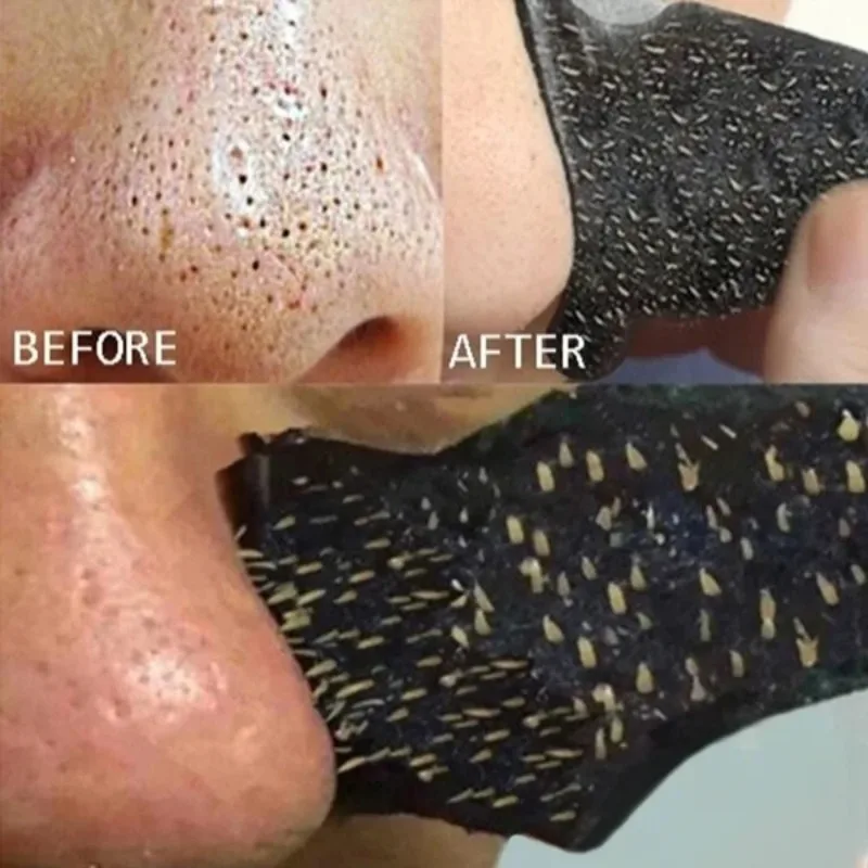 Nose Blackhead Remover Mask Deep Cleansing Skin Care Shrink Pore Acne Treatment Nose Black dots Pore Clean Strips 10-50pcs blackhead remover,blackhead instrument,acne stickers