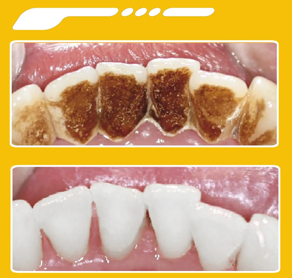 Dentifrice violet pour blanchiment des dents et anti-taches_voghion.com