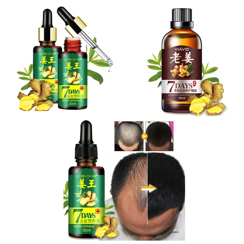 

30ml Fast Powerful Growth Hair Growth Essence Hair Loss Products Essential Oil Liquid Treatment Preventing Hair Loss Hair Care