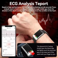 New Uric Acid Blood lipids Smart Bracelet Men ECG Blood Pressure Heart Rate Call Reminder Health Smart Bracelet No Screen Design - Image 3