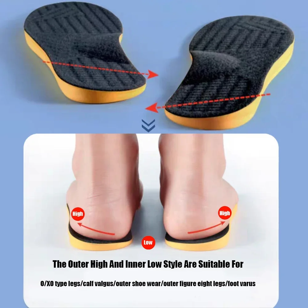 Orthopedic Insole Arch Support For Women Men O/X-Leg Pads Foot Care Inserts Shoe Insole For Flat Footed Cushion Protector 1Pair shoe insoles sport insoles orthopedic insoles sport orthopedic insoles sports insoles heel insoles