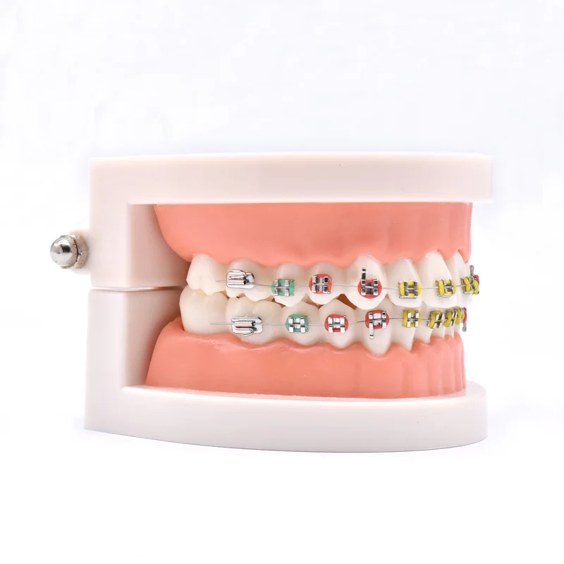 Dental Orthodontic Treatment Teeth Model With Bracket Arch Wire Buccal Tube Ligature Ties Dentist Lab Tooth Model Teaching Tools 5