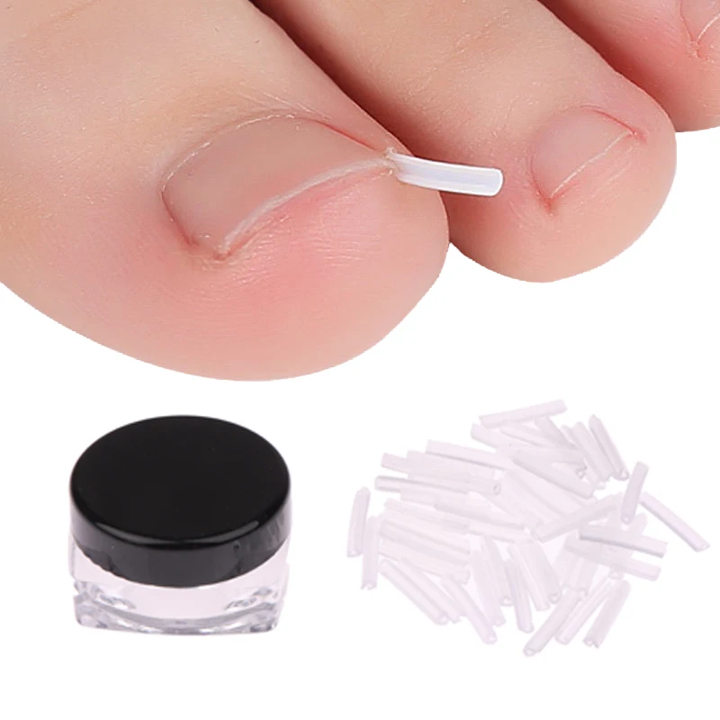 

Ingrown Toenail Correction Tool Ingrown Toe Nail Treatment Elastic Patch Sticker Straightening Clip Brace Pedicure Tool