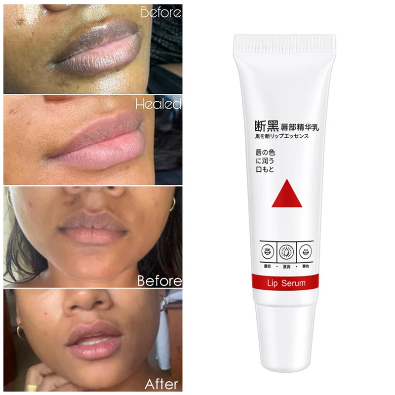 

Naturally Pink Serum Lips Pink Fresh Remove Dark Lips Gel Lightening Essence Cream Balm Repair Fine Line Brighten Lip Exfoliator